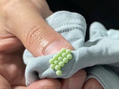 龙江除四害机构身上有臭虫怎么办